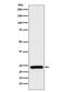 RAB25, Member RAS Oncogene Family antibody, M05115, Boster Biological Technology, Western Blot image 