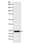 Ras-related protein Rab-25 antibody, M05115, Boster Biological Technology, Western Blot image 