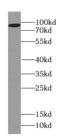 Pleckstrin And Sec7 Domain Containing 2 antibody, FNab06849, FineTest, Western Blot image 