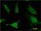 Solute Carrier Family 6 Member 16 antibody, H00028968-M13, Novus Biologicals, Immunofluorescence image 