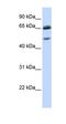 Gamma-Aminobutyric Acid Type A Receptor Gamma2 Subunit antibody, orb331576, Biorbyt, Western Blot image 