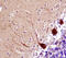 P21 (RAC1) Activated Kinase 5 antibody, MAB4696, R&D Systems, Immunohistochemistry paraffin image 