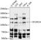 DNA Cross-Link Repair 1A antibody, 15-478, ProSci, Western Blot image 