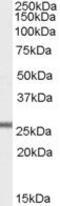 Glutathione peroxidase 3 antibody, PA5-18677, Invitrogen Antibodies, Western Blot image 