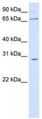 Zinc Finger And BTB Domain Containing 48 antibody, TA344491, Origene, Western Blot image 