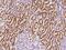 Progesterone Receptor Membrane Component 1 antibody, GTX02225, GeneTex, Immunohistochemistry paraffin image 