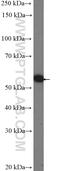 Oxysterol Binding Protein Like 2 antibody, 14751-1-AP, Proteintech Group, Western Blot image 