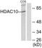 Histone Deacetylase 10 antibody, LS-C118478, Lifespan Biosciences, Western Blot image 