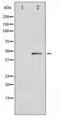 SMAD Family Member 3 antibody, LS-C416739, Lifespan Biosciences, Western Blot image 