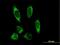 Procollagen-Lysine,2-Oxoglutarate 5-Dioxygenase 2 antibody, H00005352-B01P, Novus Biologicals, Immunofluorescence image 