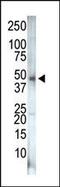 Phosphatidylinositol-5-Phosphate 4-Kinase Type 2 Gamma antibody, PA5-15289, Invitrogen Antibodies, Western Blot image 