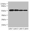 Procollagen C-Endopeptidase Enhancer 2 antibody, A60194-100, Epigentek, Western Blot image 