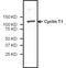 Cyclin T1 antibody, PA5-34507, Invitrogen Antibodies, Western Blot image 