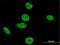 Cyclin Dependent Kinase 12 antibody, H00051755-M01, Novus Biologicals, Immunocytochemistry image 