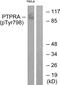 Protein Tyrosine Phosphatase Receptor Type A antibody, PA5-38323, Invitrogen Antibodies, Western Blot image 