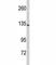 Complement C5 antibody, F51211-0.4ML, NSJ Bioreagents, Immunohistochemistry paraffin image 