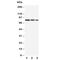 Endoglin antibody, R30466, NSJ Bioreagents, Western Blot image 