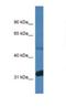 Protein Phosphatase 2 Regulatory Subunit Bdelta antibody, NBP1-74170, Novus Biologicals, Western Blot image 