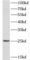 TPD52 Like 1 antibody, FNab03791, FineTest, Western Blot image 