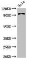 Phosphatidylinositol 3-Kinase Catalytic Subunit Type 3 antibody, CSB-PA854108LA01HU, Cusabio, Western Blot image 