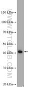 Abhydrolase Domain Containing 1 antibody, 26091-1-AP, Proteintech Group, Western Blot image 