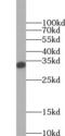 Sulfotransferase Family 2A Member 1 antibody, FNab08383, FineTest, Western Blot image 