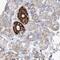 Propionyl-CoA Carboxylase Subunit Beta antibody, PA5-57880, Invitrogen Antibodies, Immunohistochemistry paraffin image 