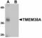 Transmembrane Protein 38A antibody, LS-B5059, Lifespan Biosciences, Western Blot image 