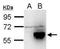 Lysine Acetyltransferase 5 antibody, GTX112197, GeneTex, Western Blot image 