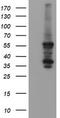 Chaperonin Containing TCP1 Subunit 8 Like 2 antibody, TA505334BM, Origene, Western Blot image 