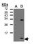 C-X-C Motif Chemokine Ligand 1 antibody, PA5-28822, Invitrogen Antibodies, Western Blot image 