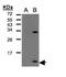 CINC-1 antibody, PA5-28822, Invitrogen Antibodies, Western Blot image 