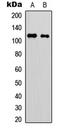 Myosin Phosphatase Rho Interacting Protein antibody, LS-C356189, Lifespan Biosciences, Western Blot image 