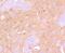 B-Raf Proto-Oncogene, Serine/Threonine Kinase antibody, A00075-2, Boster Biological Technology, Immunohistochemistry paraffin image 