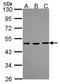 Methyl-CpG Binding Domain Protein 2 antibody, GTX105622, GeneTex, Western Blot image 