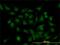Homeobox D11 antibody, H00003237-M01, Novus Biologicals, Immunofluorescence image 