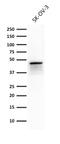 Keratin 8 antibody, GTX34667, GeneTex, Western Blot image 