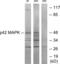 Mitogen-Activated Protein Kinase 1 antibody, abx013451, Abbexa, Western Blot image 