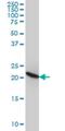 Ribosomal Protein L9 antibody, H00006133-M01, Novus Biologicals, Western Blot image 