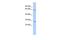 Claudin 18 antibody, GTX47767, GeneTex, Western Blot image 