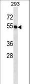 Butyrophilin Subfamily 2 Member A1 antibody, LS-C156887, Lifespan Biosciences, Western Blot image 