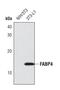 Fatty Acid Binding Protein 4 antibody, PA5-17248, Invitrogen Antibodies, Western Blot image 