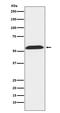 Thioredoxin Reductase 2 antibody, M03900-1, Boster Biological Technology, Western Blot image 