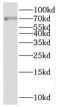 Nuclear Receptor Subfamily 2 Group C Member 2 antibody, FNab05841, FineTest, Western Blot image 