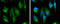 Succinate Dehydrogenase Complex Iron Sulfur Subunit B antibody, GTX113833, GeneTex, Immunofluorescence image 