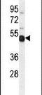 NME/NM23 Family Member 9 antibody, PA5-24494, Invitrogen Antibodies, Western Blot image 