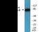 Component Of Inhibitor Of Nuclear Factor Kappa B Kinase Complex antibody, EKC2043, Boster Biological Technology, Western Blot image 