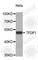 Transcription Factor Dp-1 antibody, A5569, ABclonal Technology, Western Blot image 