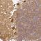 Cyclase Associated Actin Cytoskeleton Regulatory Protein 2 antibody, NBP2-30572, Novus Biologicals, Immunohistochemistry frozen image 