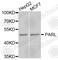 Presenilin Associated Rhomboid Like antibody, A8232, ABclonal Technology, Western Blot image 